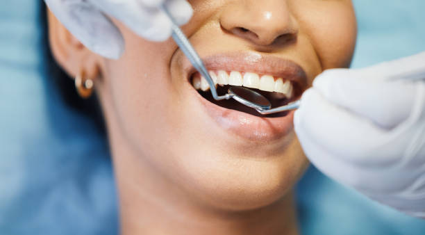 Best Emergency Tooth Extraction in Mentone, CA
