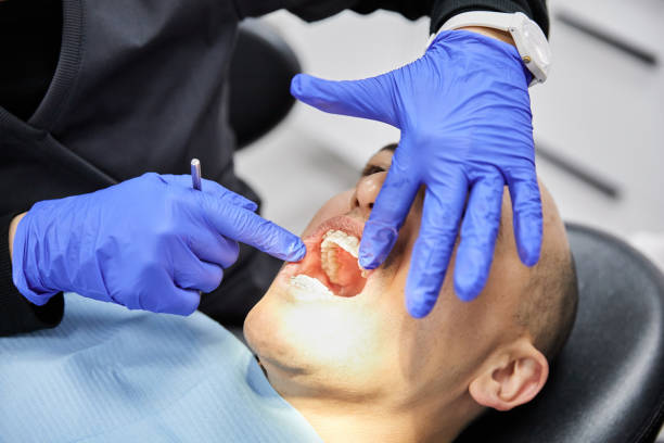 Best Emergency Tooth Extraction in Mentone, CA