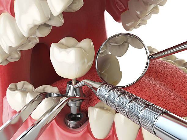 Best Emergency Dental Surgery in Mentone, CA
